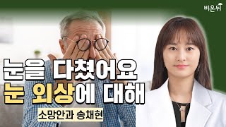 눈을 다쳤어요 - 눈 외상에 대해 / 소망안과 송채현