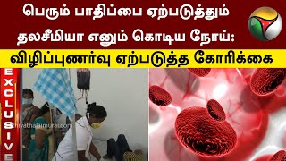 தலசீமியா எனும் கொடிய நோய்: விழிப்புணர்வு ஏற்படுத்த பாதிக்கப்பட்டவர்கள் கோரிக்கை! | Thalassemia | PTT