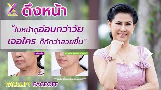 64 ดึงหน้าเฟซออฟ เพราะมั่นใจ ใบหน้าดูอ่อนกว่าวัย ใครก็ทักว่าสวยขึ้น