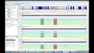 Identification of Candidate Functional Polymorphism Using Trio Family Whole Exome DNA Data