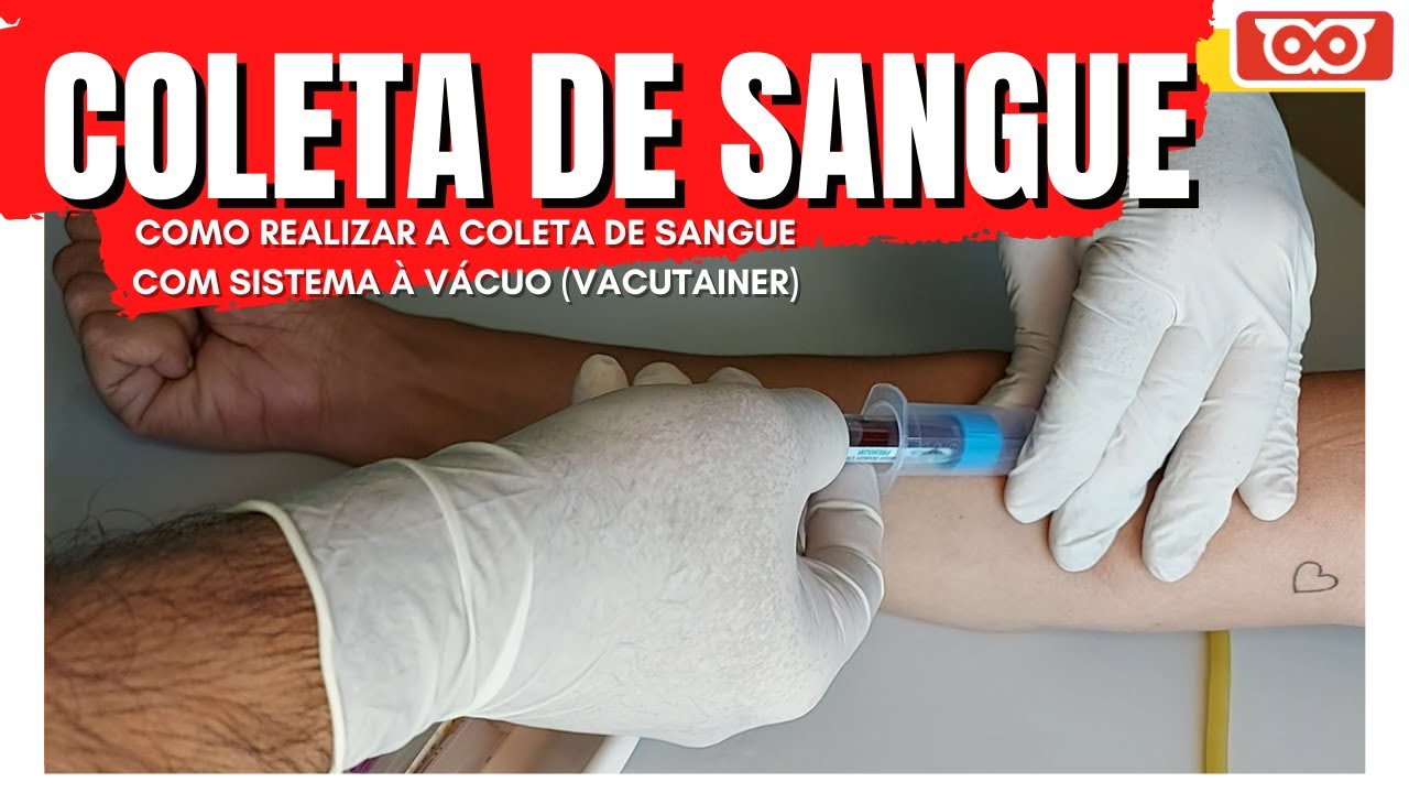 COLETA DE SANGUE COM SISTEMA A VÁCUO - YouTube