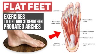 Flat Feet - Rehab Exercises for Pronated Arches