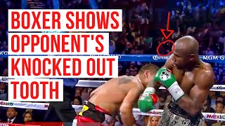 Boxer Shows Opponent's Knocked Out Tooth