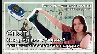 СПОТ - Синдром постуральной ортостатической тахикардии | POTS | Головокружение при вставании? Оно!