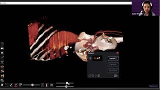 Working with the Case Library and DICOM Files on the Anatomage Table