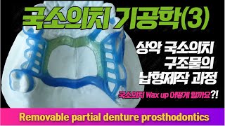 수성대학교 치기공과 국소의치기공학(3) 원격수업 3_2 상악의 납형제작(wax up)