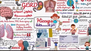 Hiccups causes and ttt الزغطه  الاسباب و العلاج  دكتور ايمن مرسي