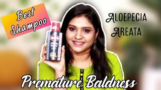 வழுக்கை முடி உதிர்வுக்கு இந்த Shampoo பயன்படுத்தினால் போதும் 🌹 Weekly Giveaway worth 5k products