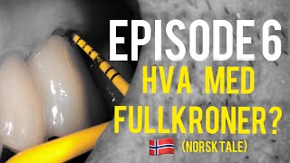 Episode 6 - Hva med fullkroner?