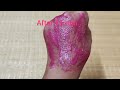 home remedy for pinkish glowing skin பொழிவான சர்மம் பெற இதை பயன்படுத்துங்கள் 👸🏻