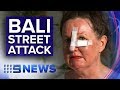 Perth mum bashed on Bali street | Nine News Australia