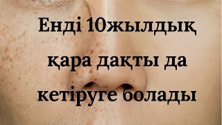 Беттегі 10ж қара дақты да кетіруге болады|Как удалить черные пятна на лице|Бетті қара дақты кетір