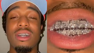 Quavo Huncho Shows New Iced Out Grill 💎