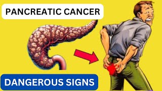 8 Signs of PANCREATIC CANCER That Will Leave You Speechless!