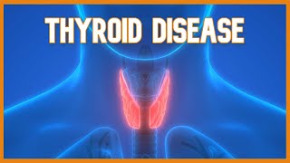 Thyroid Disease (Hyperthyroidism vs. Hypothyroidism)