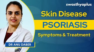 Psoriasis: Symptoms and Treatment | Skin Disease | Dr Anu Daber