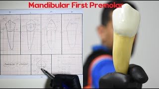 Drawing of Mandibular First Premolar | رسم الأسنان