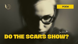 Do The Scars Show // Spoken Word // Poem