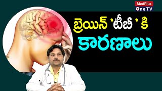 Brain TB Causes and Treatment | Dr.Murali Krishna | @MedPlusONETV