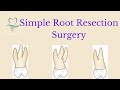 SIMPLE MAXILLARY ROOT RESECTION SURGERY | Dr.K.A.REDDY | BEST ENDODONTIST