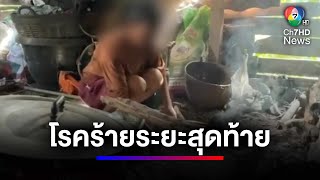 หญิงป่วยโรคมะเร็งระยะสุดท้าย วอนช่วยเหลือลูก | สนามข่าว 7 สี