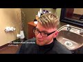 james testimonial hri men s dermal lens non surgical hair replacement