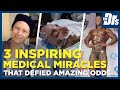 3 Inspiring Medical Miracles That Defied Amazing Odds