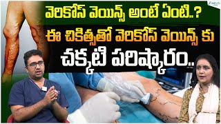 Understanding Varicose Veins | Varicose Veins Treatments | Dr. Viswanath Atreya | Sakshi Life