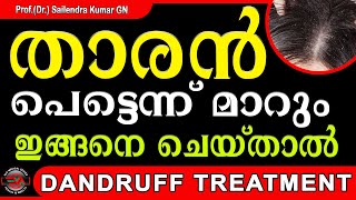 DANDRUFF TREATMENT | താരൻ പെട്ടെന്ന് മാറും ഇങ്ങനെ ചെയ്താൽ | EVA MEDICAL SERIES