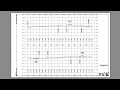 Civil 3D 2018 New Feature: Plan/Plan & Profile/Profile Sheets