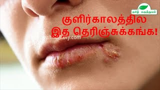 Fast cold sore treatment at home | Best cold sore treatment