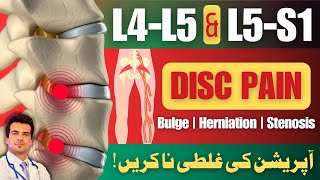 L4-L5 \u0026 L5-S1 Disc Bulge Treatment | No Surgery | Home Treatment | Urdu/Hindi