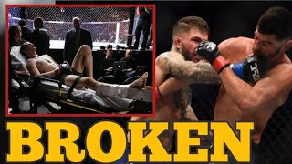 BREAKING NEWS🛑UFC CHAMPION DOMINICK CRUZ  WILL NEVER FIGHT AGAIN AFTER TRAGIC INJURY