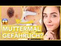 MUTTERMAL entfernen – wann es GEFÄHRLICH wird