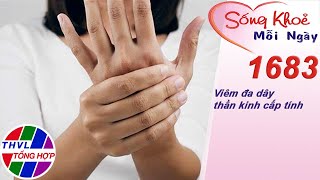 Viêm đa dây thần kinh cấp tính | Sống khỏe mỗi ngày - Kỳ 1683