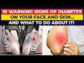 10 Warning Signs of Diabetes On Your Face And Skin... And What To Do About It!