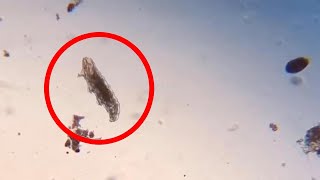 Scientist Shows Amazing Microscopic Animals