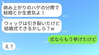 闘病中で髪の毛がない私を嫌って、結婚式の日にウィッグを引き裂いた従姉妹「ハゲが結婚するなw」→喜ぶ彼女にとんでもない事実を伝えた時の反応がwww