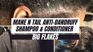 Mane N Tail Anti-Dandruff Shampoo \u0026 Conditioner Review ♡ Forever Latisha