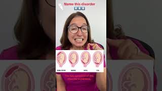 Name this Disorder #45: Maternity Nursing SHORT | @LevelUpRN