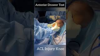 Anterior Drawer Test # ACL injury knee # Short video # Dr.Prashantkumar # Ortho Care