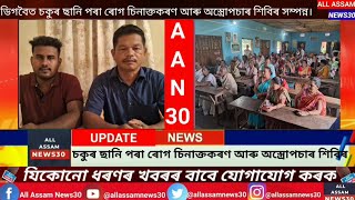 Digboi News | ডিগবৈত চকুৰ ছানি পৰা ৰোগ চিনাক্তকৰণ আৰু অস্ত্ৰোপচাৰ শিবিৰ সম্পন্ন