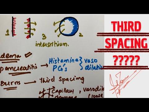 What causes 3rd space fluid?