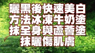 曬黑後快速美白方法冰凍牛奶塗抹全身與蘆薈塗抹曬傷肌膚