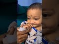 cleft cutie s beautiful smile after cleft lip repair in india shorts