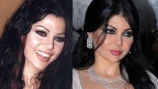 هيفاء وهبي - قبل وبعد عمليات التجميل - haifa wehbe before after surgery