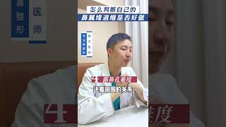 怎么判断自己的鼻翼缘是否好做？