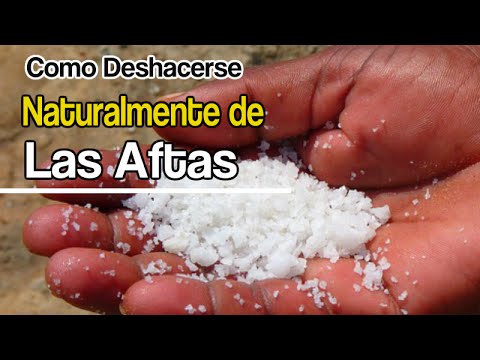 Como sanar ulceras en la boca