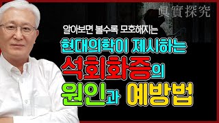 [E747] 현대의학이 제시하는 석회화증의 원인과 예방법 - 골다공증 탈출을 위한 '뼈건강 바이블' 제35부