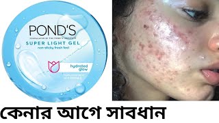 Pond's Super Light Gel Honest Review In Bengali | Pond's Super Light Gel Review | Pond's|Nyza Zaarin